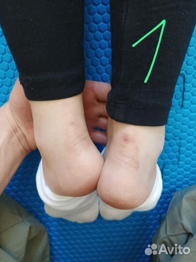 Сколиоз, осанку исправлю Юмейхо