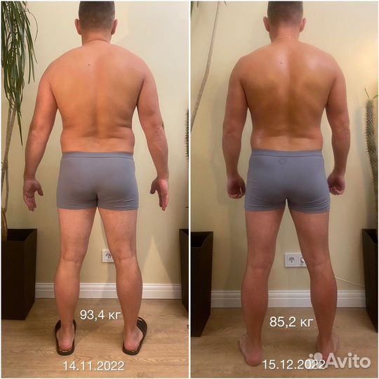 Безоперационная липосакция