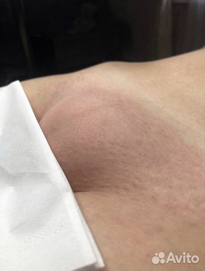 Депиляция воском