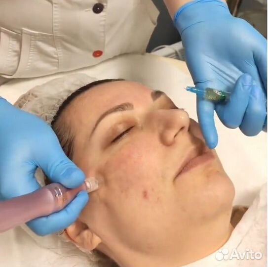 Шугаринг депиляция