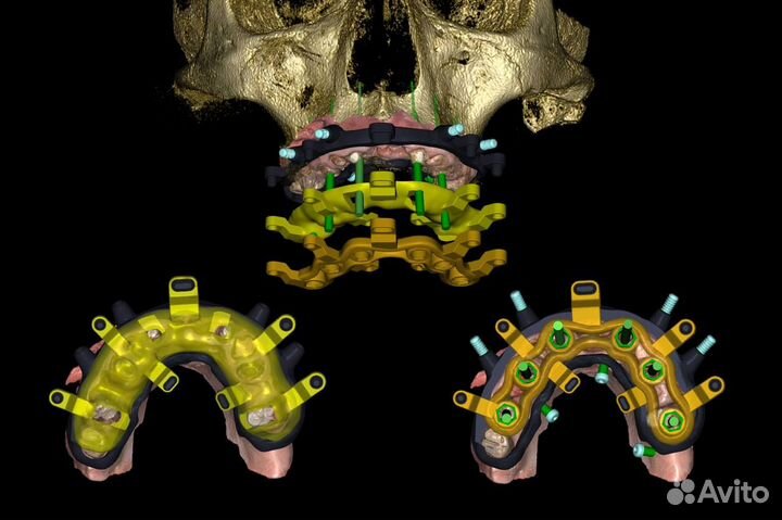 PlastyCad v1.7& 3Diagnosys v4.2 + Обучение