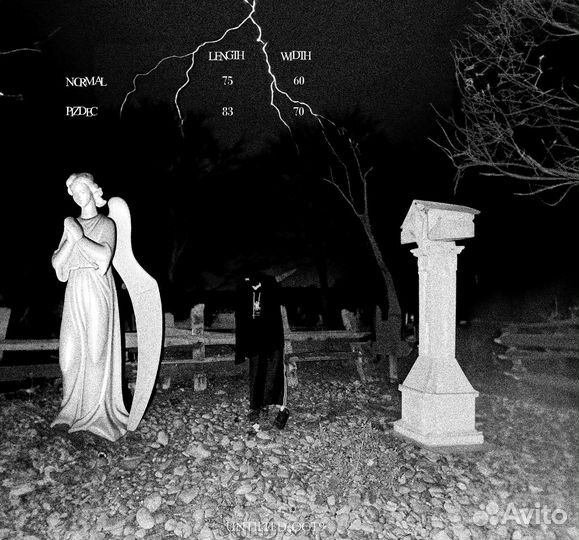 Conjunctiva untilted oct-9