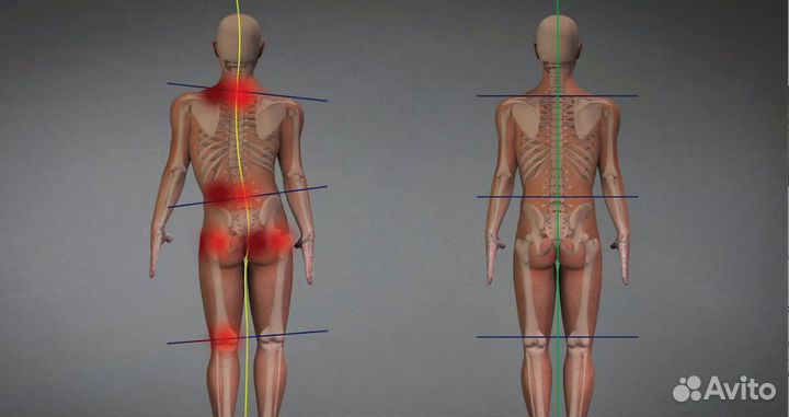 Массаж, коррекция осанки
