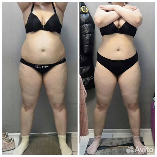 LPG массаж антицеллюлитный для похудения