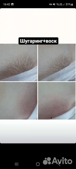 Эпиляция воском и шугаринг