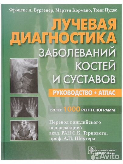 Лучевая диагностика,рентгенология,кт,мрт