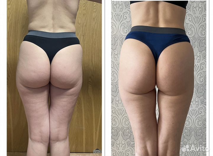 Массаж ручной и аппаратный