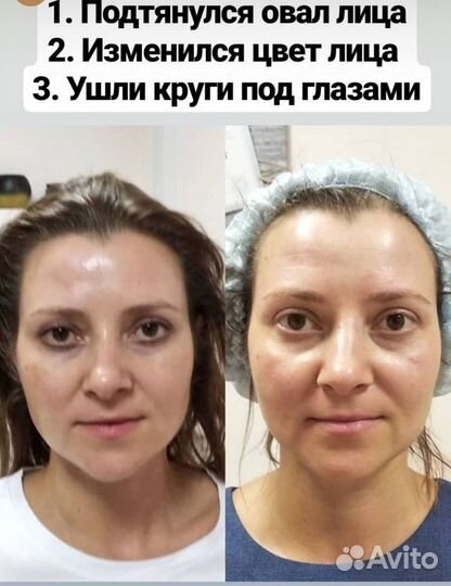 Массаж. Лимфодренажный массаж. Массаж тела