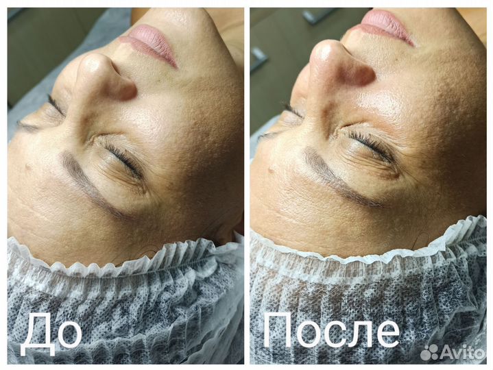 Услуги косметолога