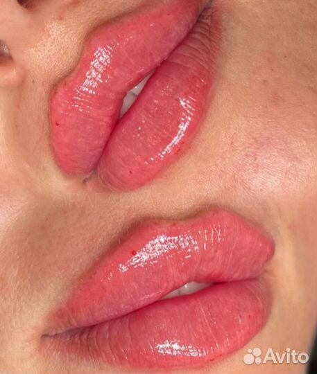 Увеличение губ