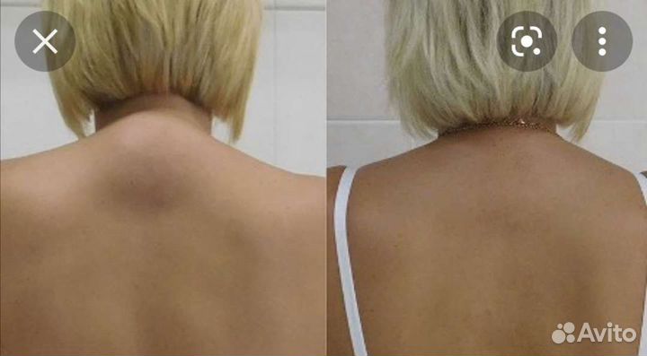 Проф. Массаж