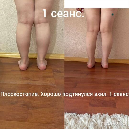 Правка тела. Остеопатия. Краниосакральная терапия