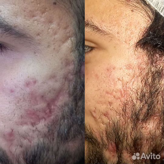 Безъиньекционная уходовая косметология