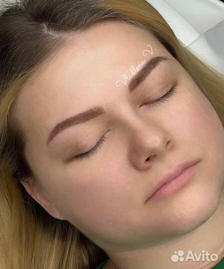 Микроблейдинг