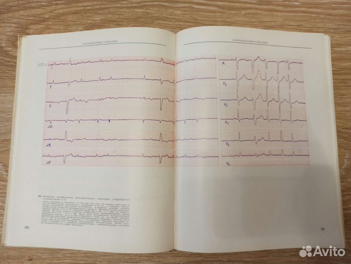 Медицинская литература.экг