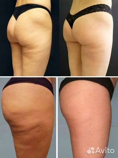 Массаж.Лпдж массаж.вибромассаж.Лпдж массаж лица