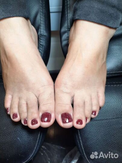 Маникюр и педикюр, установка титановой нити