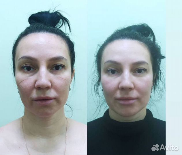 Массаж. Лимфодренажный массаж. Массаж тела