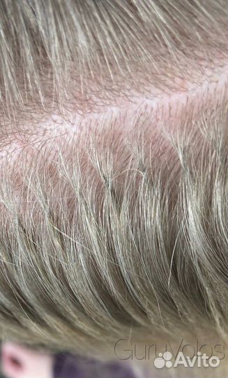 Наращивание волос