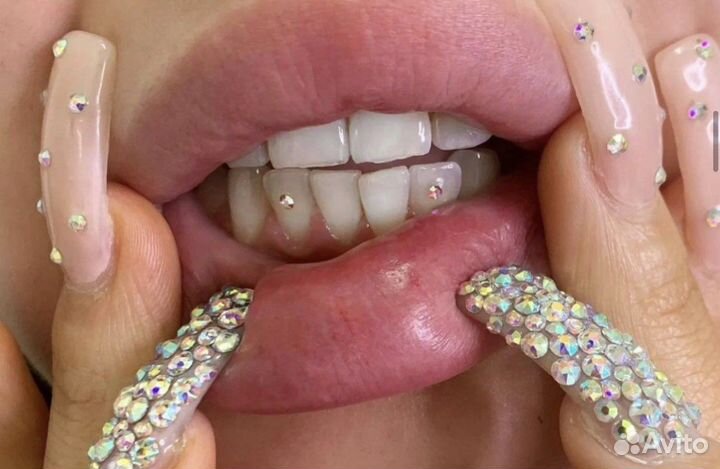 Скайсы и обучение установки скайсам