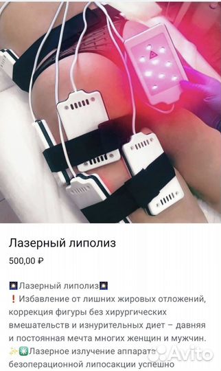 Миостимуляция тела