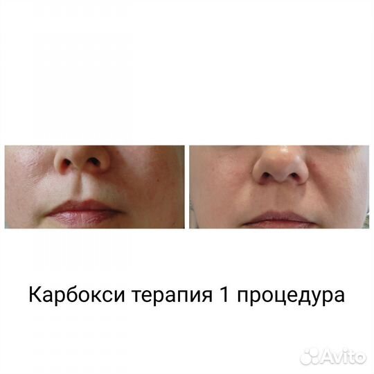 Услуги косметолога