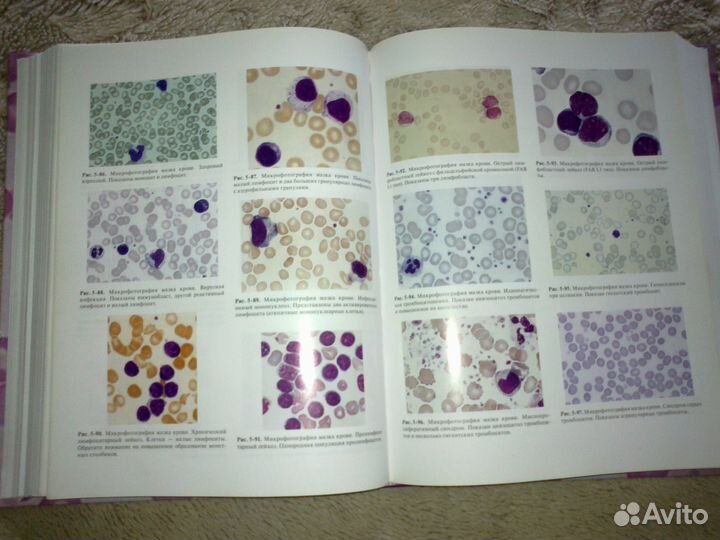 Практическая и лабораторная гематология Льюис С.М