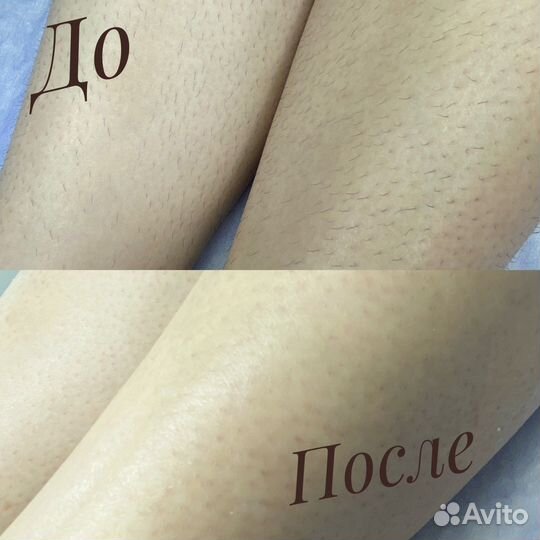 Шугаринг. Ваксинг