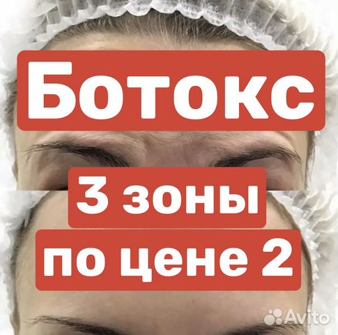 Ботокс для лица