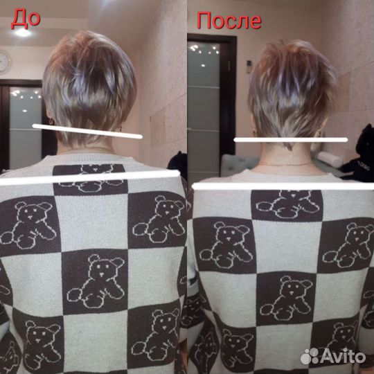 Аппаратный массаж шейно-воротниковой зоны