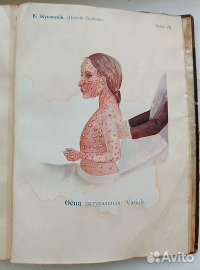 Курс детских болезней