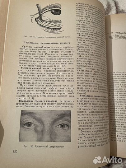 Книга Глазные болезни