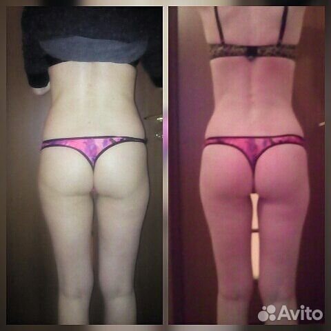 Абонемент на курс коррекции фигуры