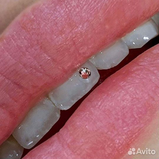 Модели на скайсы и осветление эмали