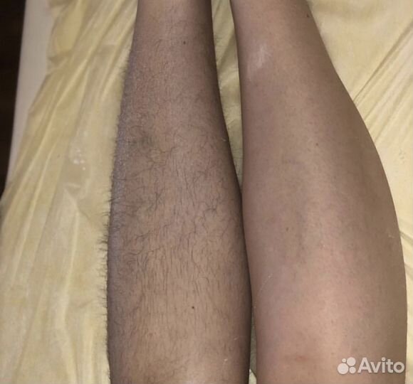 Шугаринг