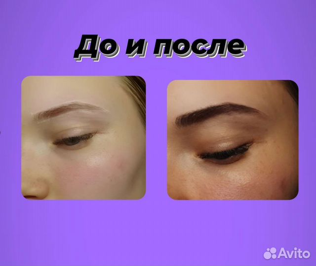 Брови, ресницы