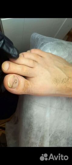 Услуги подолога. Подолог