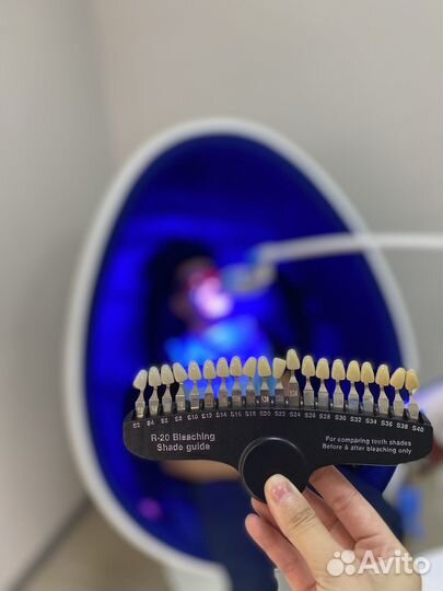 Шкала для определения оттенка зубов