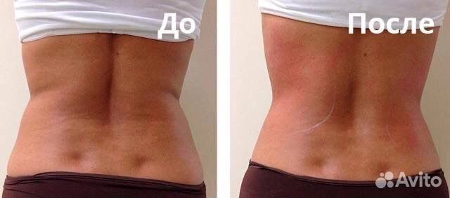 Коррекция фигуры