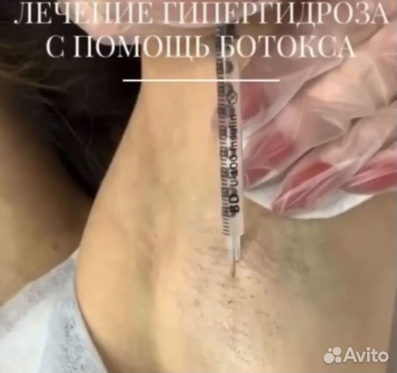 Ботокс лоб,глаза