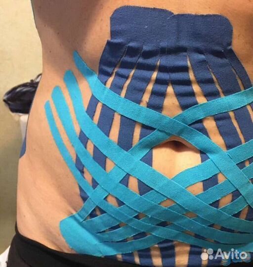 Тейпирование, массаж