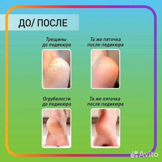 Кератолитик и Нейтролизатор