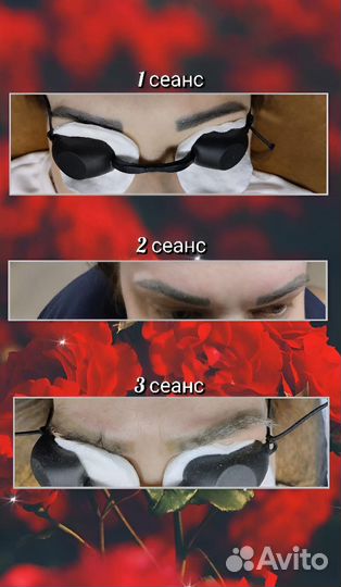 Лазерное удаление тату