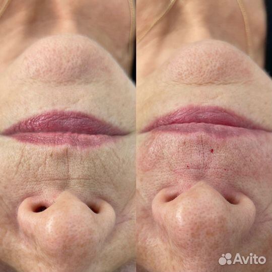 Врач косметолог