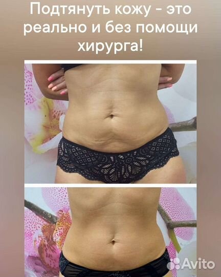 Коррекция фигуры