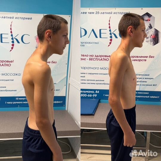 Правка Атланта atlasprofessional