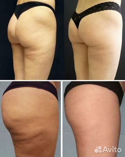 Массаж в Удовольствие