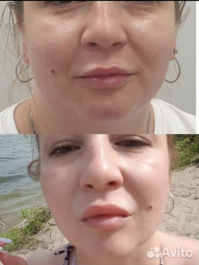 Худое тело, лицо