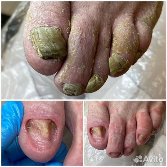 Подолог/медицинский педикюр