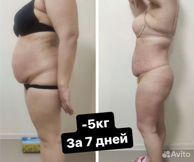 Аппаратный массаж. Антицеллюлитный. Коррекция фигу